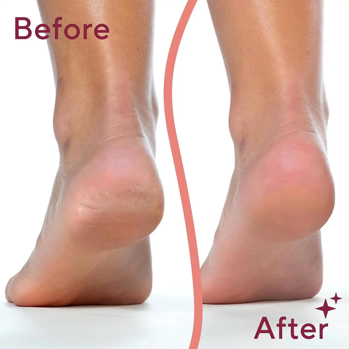 Electric Foot File