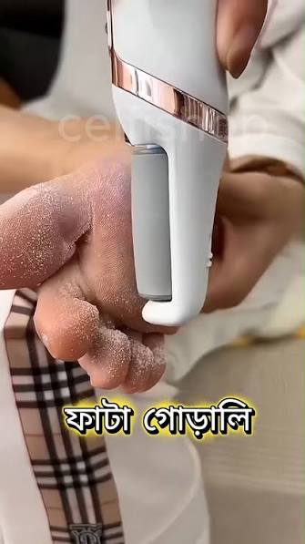 Electric Foot File